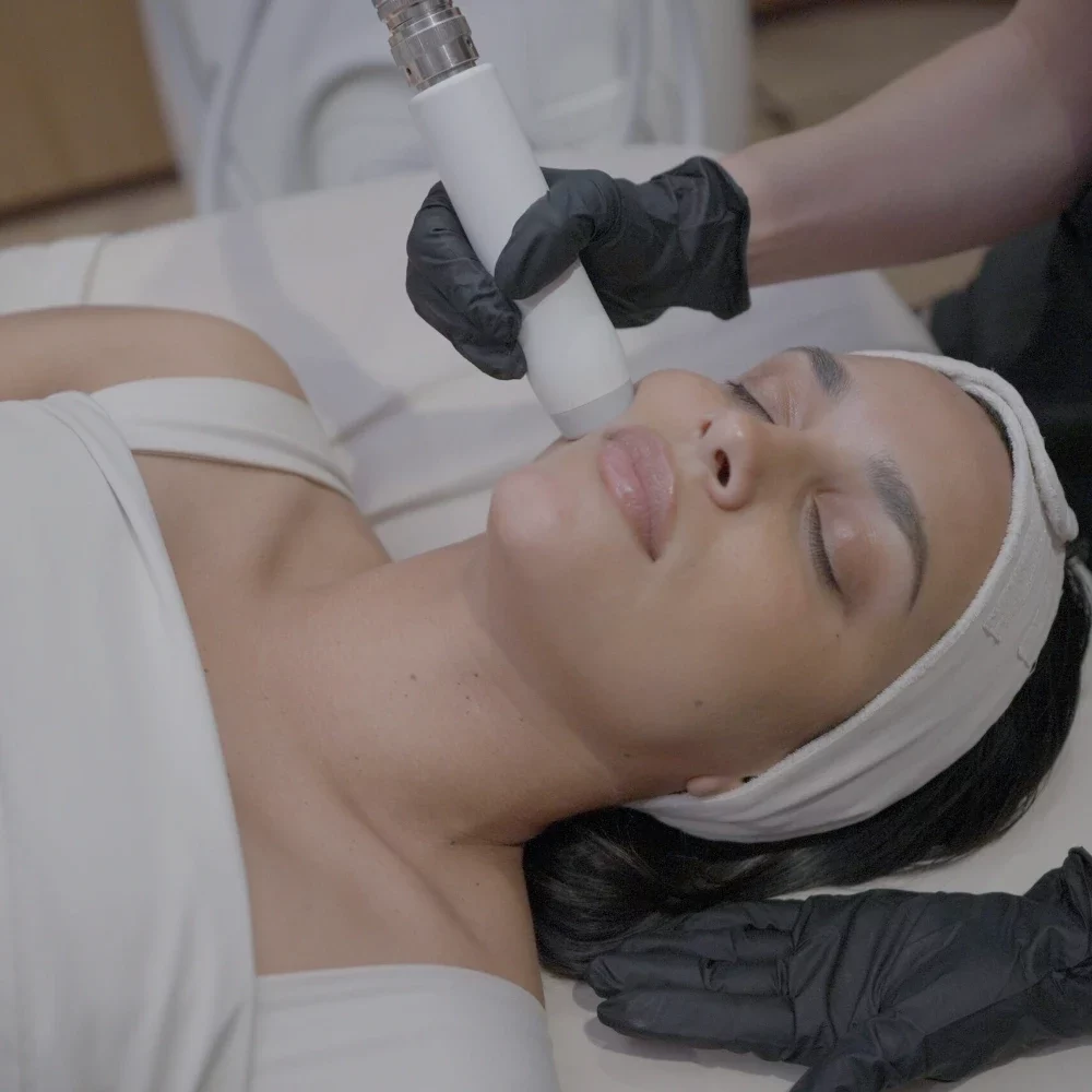 T-Shape 2 facial treatment on the cheek at iCRYO Helotes